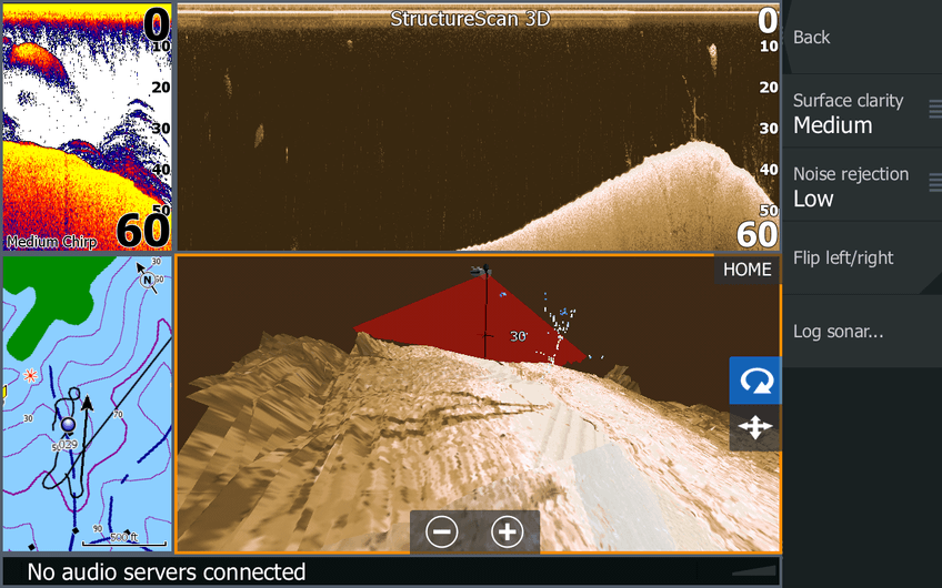 3D STRUCTURE SCAN MODULE AND XDCR 000-12395-001